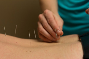 acupunture for diabetes