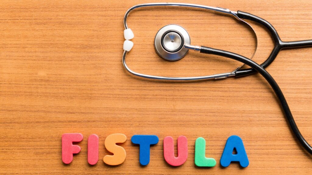 fistula