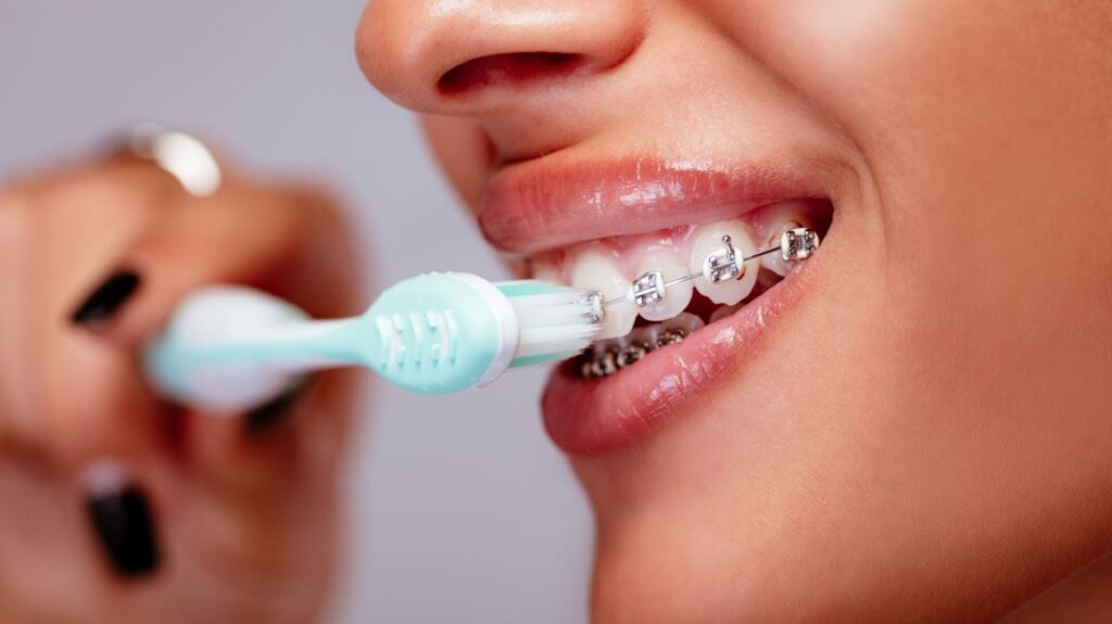 braces teeth care tips